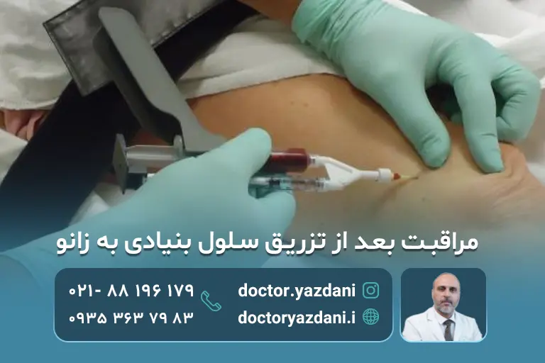 مراقبت پس از تزریق سلول بنیادی به زانو